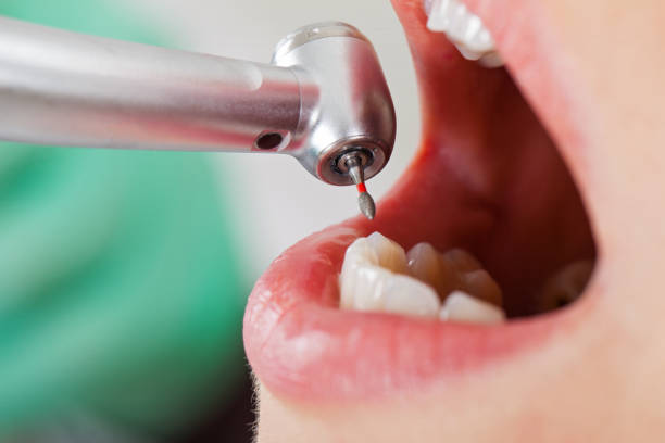 Best Knocked-Out Tooth Emergency  in St Augustine South, FL